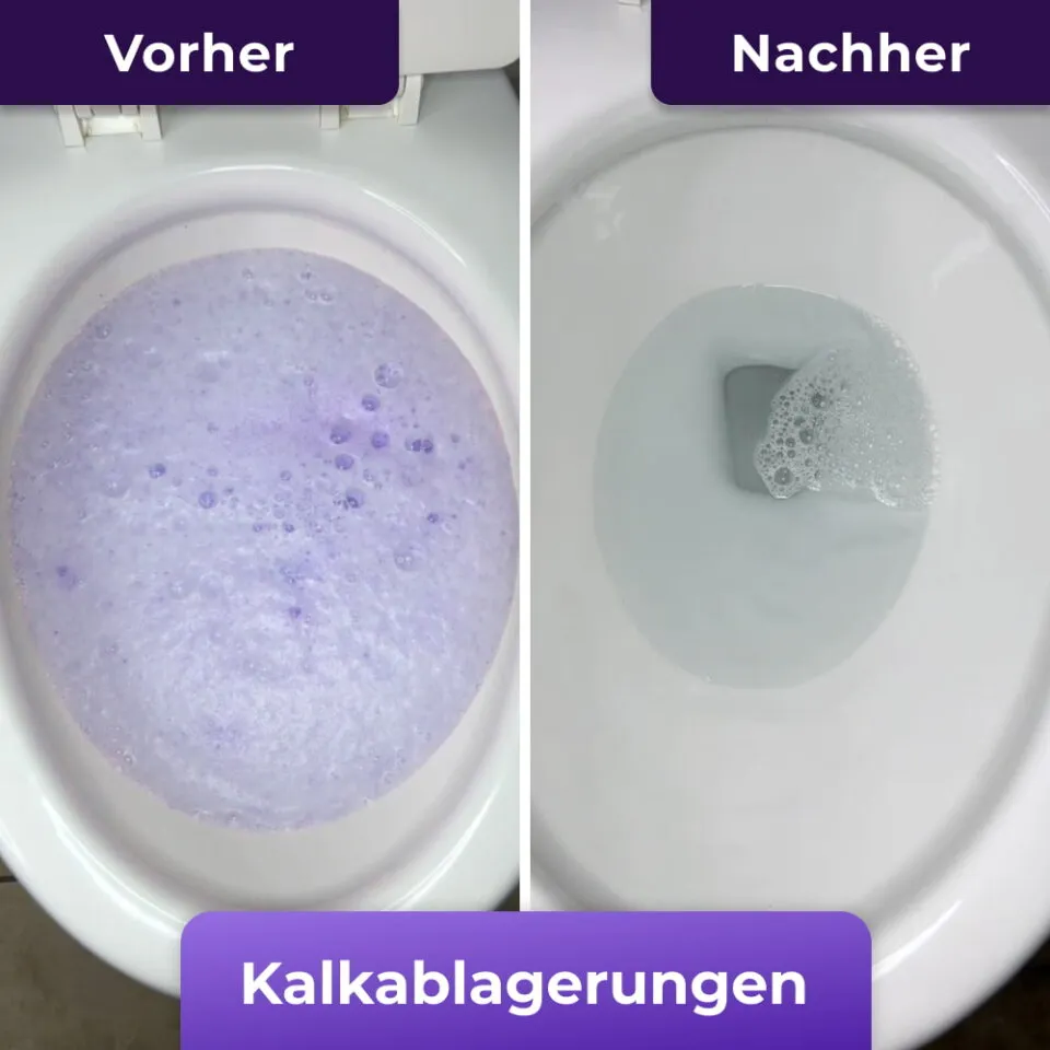 imgi_141_SGVyb182X0JlZm9yZV9BZnRlcl90b2lsZXRfZm9hbV9GaXp6Q2xlYW4tREUuanBn-h_960